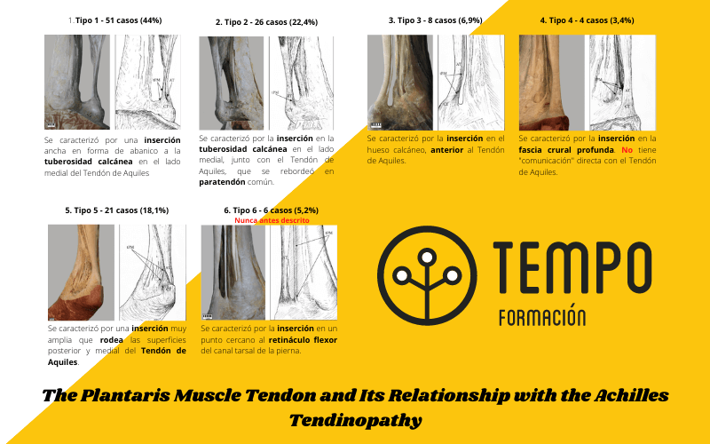 4. Preguntas y respuestas ecografia fascitis plantar delgado plantar osgood schlatter.png